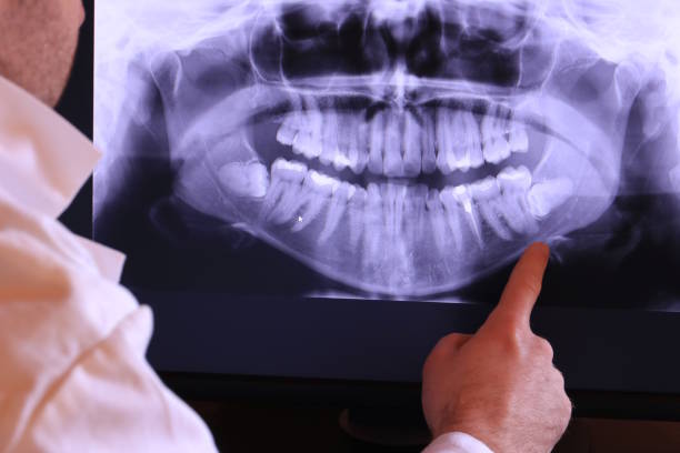 Best Emergency Gum Treatment in Post Falls, ID